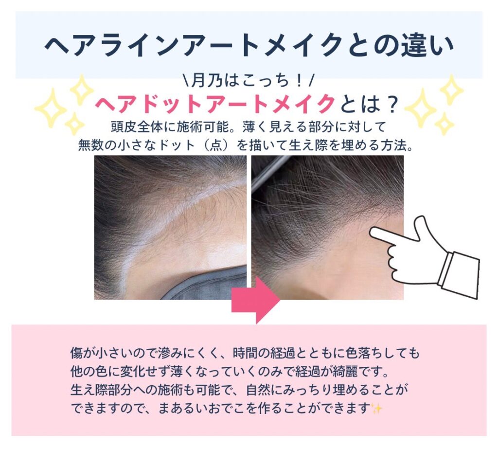 ヘアラインアートメイクとヘアドットアートメイクの違い