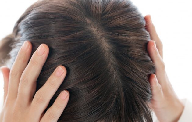 つむじが薄く見えてしまう原因がわからず悩んでいる女性
